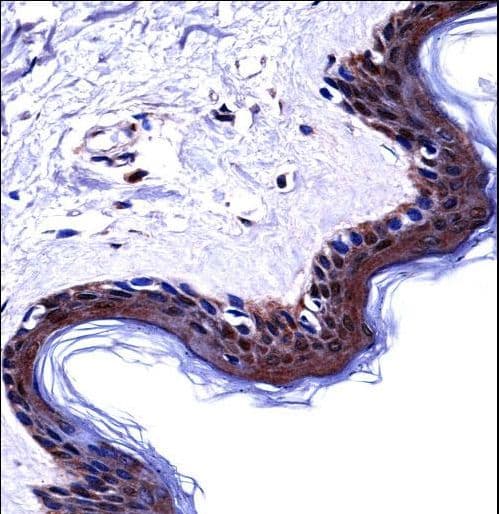 DSG1 / Desmoglein 1 Antibody (aa471-499)