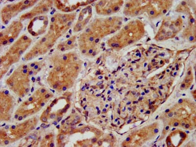 KCNJ8 / Kir6.1 Antibody