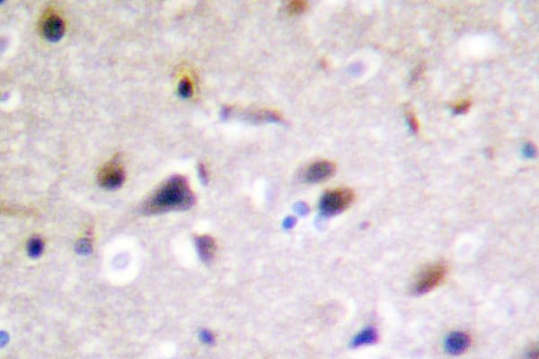 Polyclonal Rabbit anti-Human DPYSL2 / CRMP2 Antibody (Pro510, IHC, IF, WB)