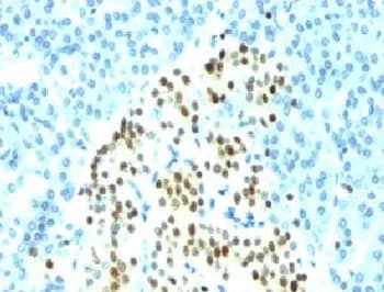 NKX2-2 Antibody (clone SPM564)