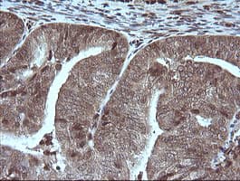 MAP2K1 / MKK1 / MEK1 Antibody (clone OTI3H5)