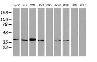 MAGEB1 Antibody (clone OTI4E12)