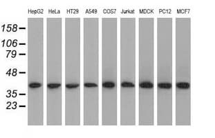 ACAT2 Antibody (clone OTI3E2)
