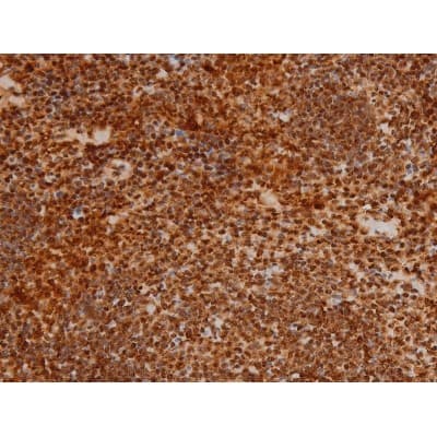 Polyclonal Rabbit anti-Human EZR / Ezrin Antibody (phospho-Tyr353, IF, WB)