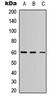 Polyclonal Rabbit anti-Human ERF / PE2 Antibody (C-Terminus, IHC, WB)