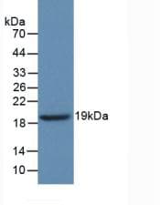 GBA / Glucosidase Beta Acid Antibody (aa334-498, APC)