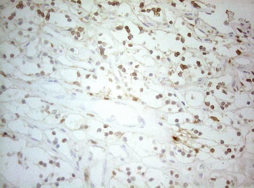 ALOX5 / 5-LOX Antibody (aa18-364, clone OTI2C5)