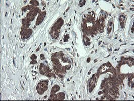 FAM164A / CGI-62 Antibody (clone OTI4C1)