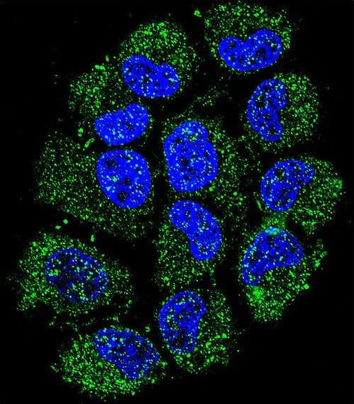 C12orf29 Antibody (aa61-89)