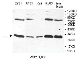 Esterase D / ESD Antibody (aa147-282)