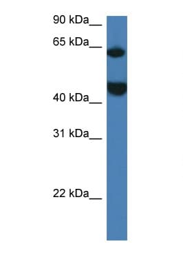 Polyclonal Rabbit anti-Mouse LPCAT2 Antibody (aa167-216, WB)