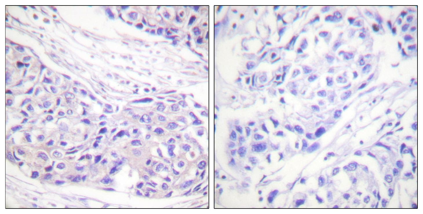 RPS6KA1 / RSK1 Antibody (p359/363)