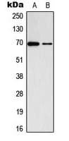 ADCK2 Antibody (Internal)