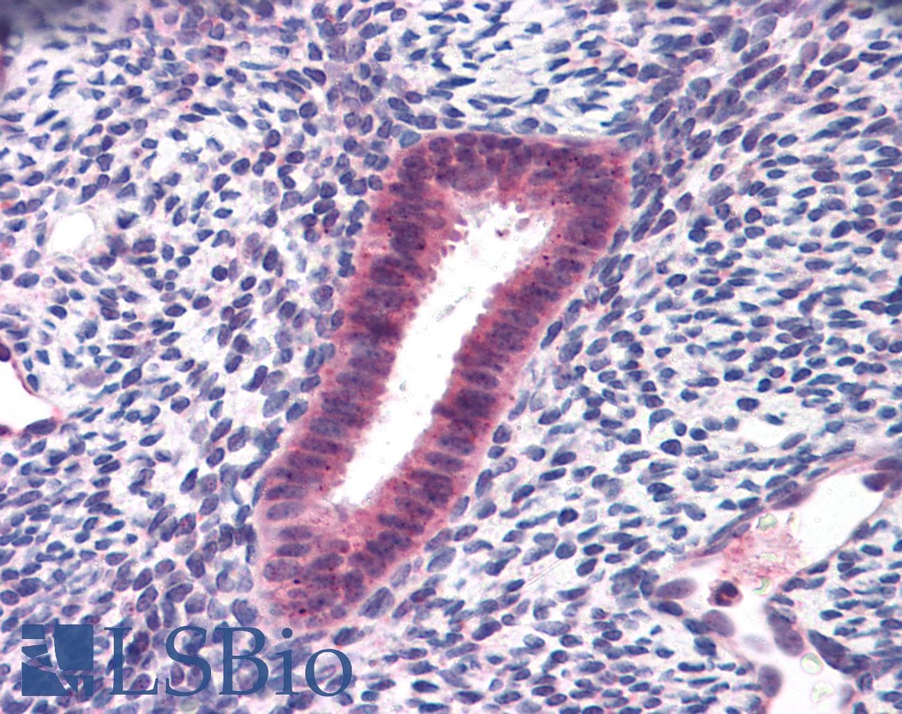 IHC-plus™ Polyclonal Rabbit anti-Human FOXN1 Antibody (IHC, WB)