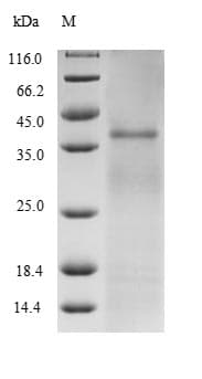 Mycobacterium tuberculosis Ag85B Protein (Recombinant 6His, N-terminus)