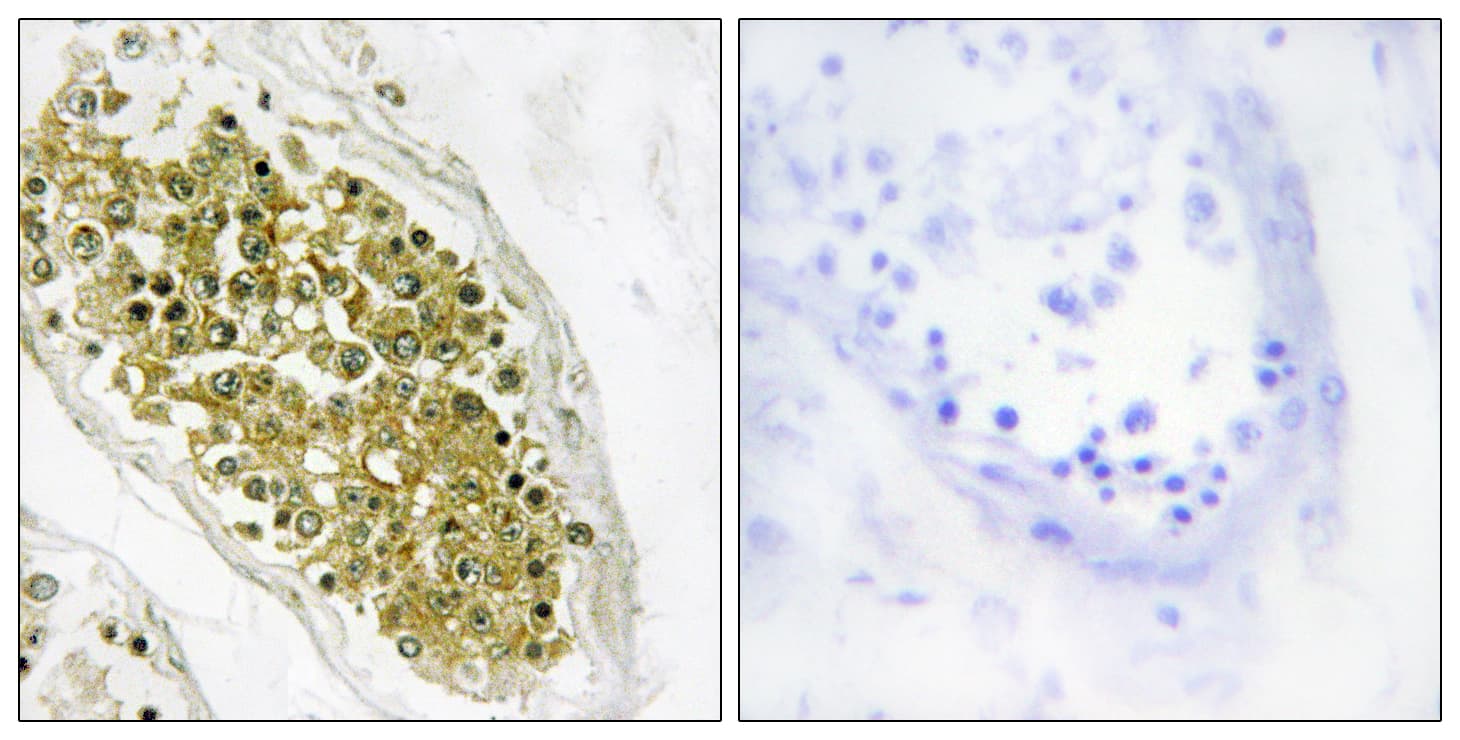 Polyclonal Rabbit anti-Human HIPK4 Antibody (aa511-560, IHC, IF, WB)