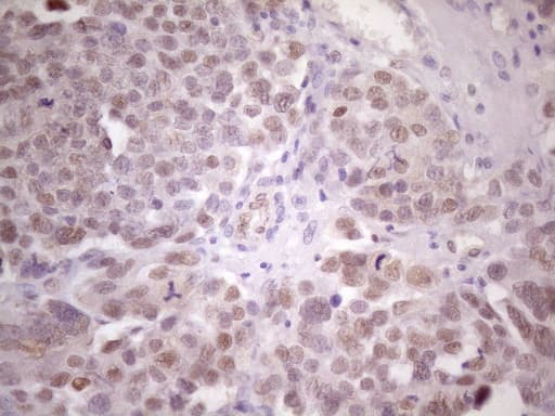 ZNF200 Antibody (clone OTI5F4)