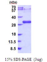 Human LTBR Protein (Recombinant His)
