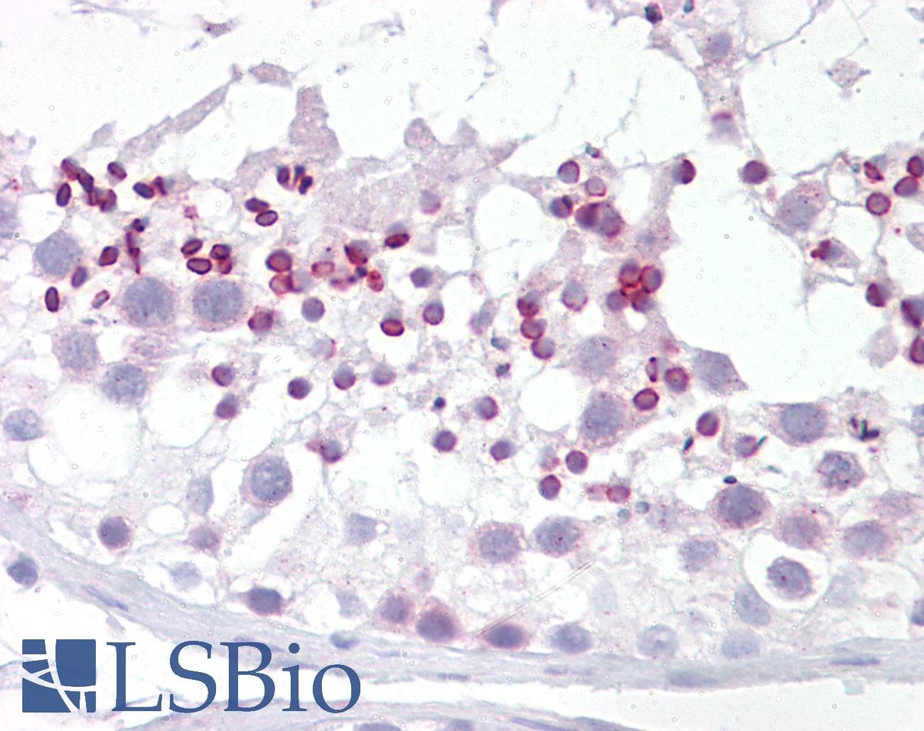 IHC-plus™ Polyclonal Rabbit anti-Human DYRK2 Antibody (IHC, IF, WB)