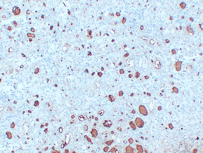 TG / Thyroglobulin Antibody (clone ABT-TG)