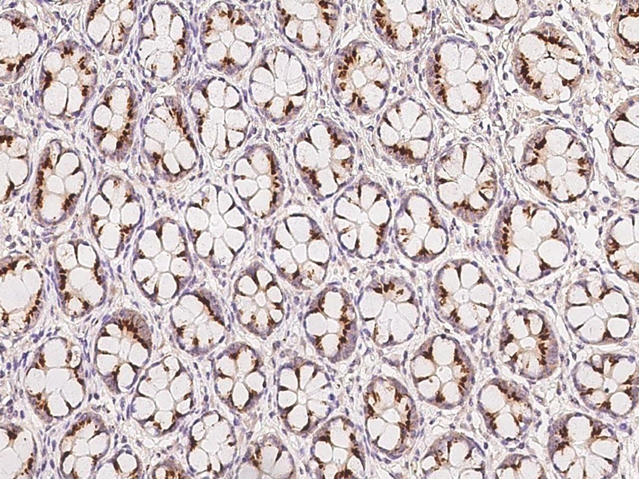 ALMS1 Antibody