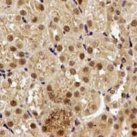 PPP2R2A Antibody