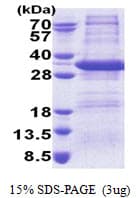 Human STX17 / Syntaxin 17 Protein (Recombinant His)