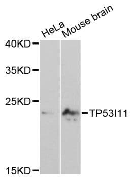 TP53I11 / PIG11 Antibody