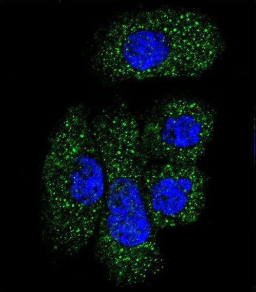 SERPING1 / C1 Inhibitor Antibody (aa285-314)