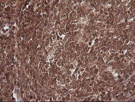 MAGEA4 Antibody (clone OTI2C1)