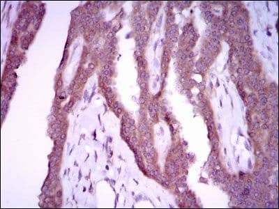 NOS2 / iNOS Antibody (clone 400000)