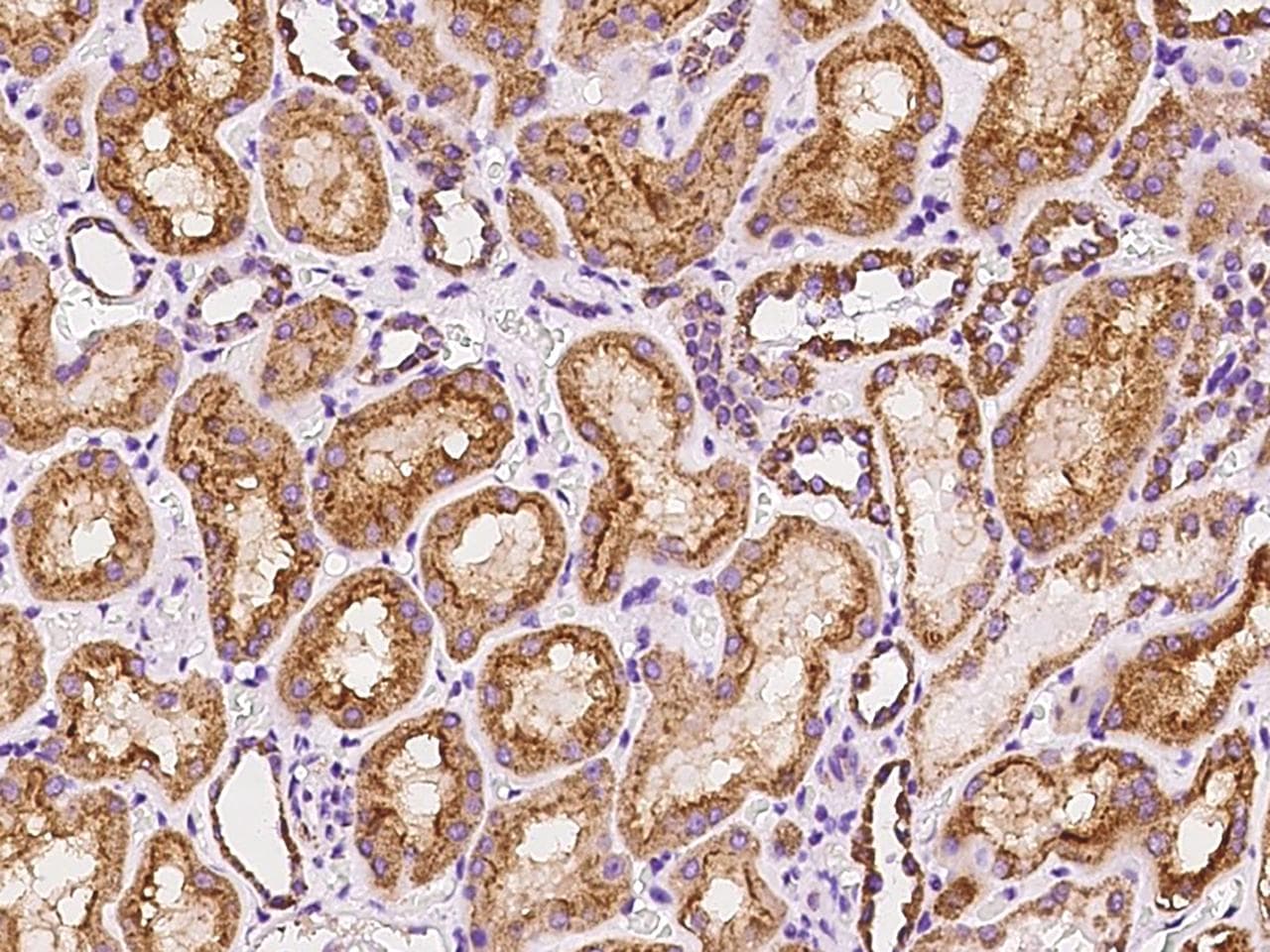 FAM151A Antibody