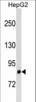 LRRIQ3 Antibody (aa552-581)