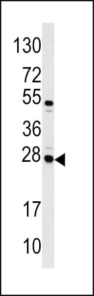 Polyclonal Rabbit anti-Human Alpha-S1-Casein / CSN1S1 Antibody (aa42-70, IHC, WB)