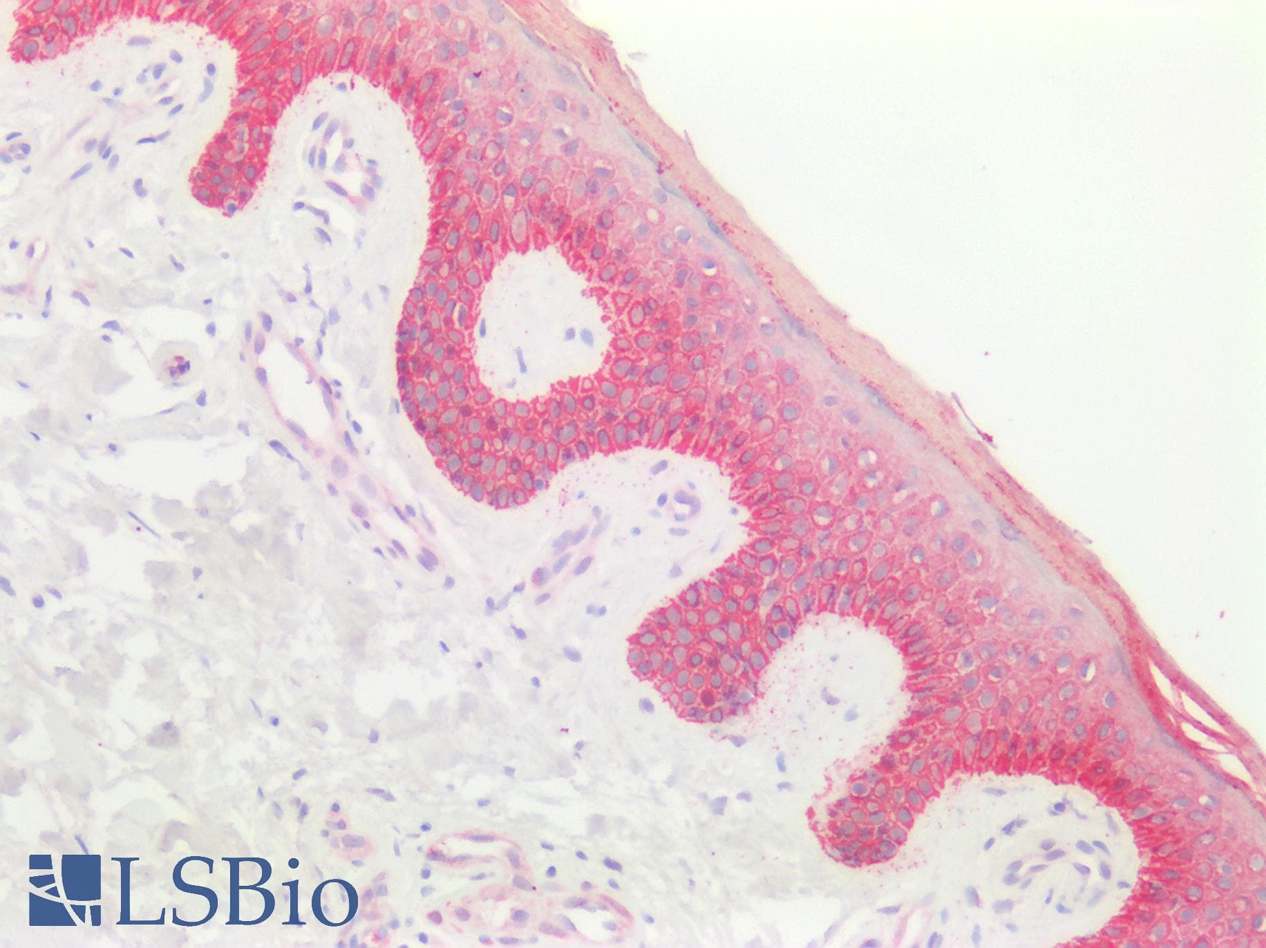 PathPlus™ KRT5 / CK5 / Cytokeratin 5 Antibody