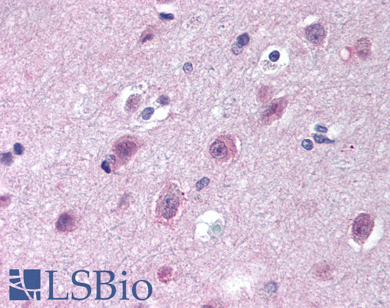 IHC-plus™ IPO9 / Importin 9 Antibody (aa950-1000)