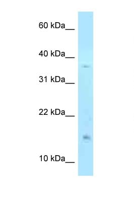 Polyclonal Rabbit anti-Human PHLDA2 / TSSC3 Antibody (N-Terminus, WB)