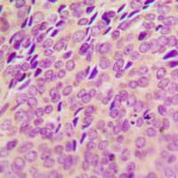 SYK Antibody (phospho-Tyr348)
