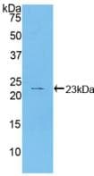 HSPB2 / HSP27 Antibody (aa12-182, PE)