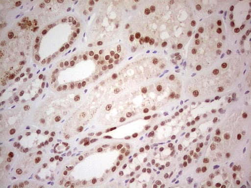 PPP1R8 / Rnase E Antibody (aa1-225, clone OTI2E12, Carrier-free)