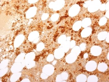 CD71 / Transferrin Receptor Antibody (clone TFRC/1817, Azide-free, BSA-free)