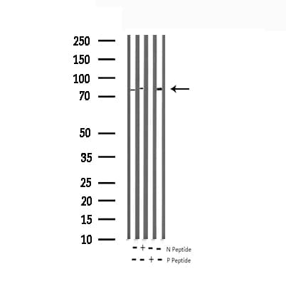 RAF1 / RAF Antibody (phospho-Ser621)