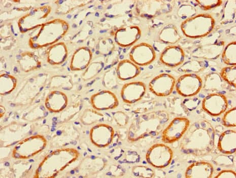 Polyclonal Rabbit anti-Human PIGP Antibody (IHC, IF)