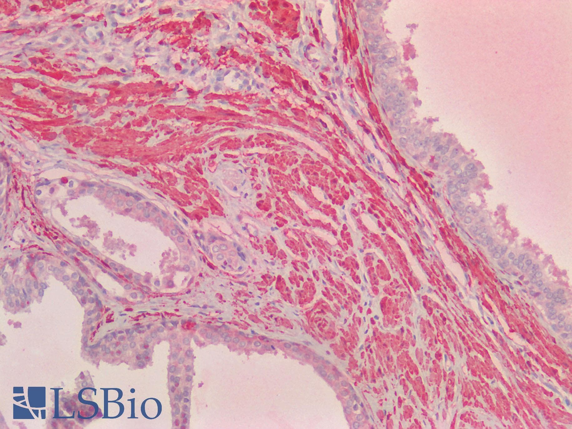 IHC-plus™ TAGLN / Transgelin / SM22 Antibody (C-Terminus)
