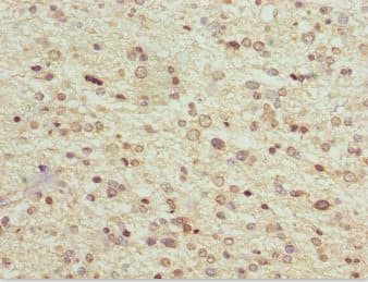 MAGED1 / NRAGE Antibody