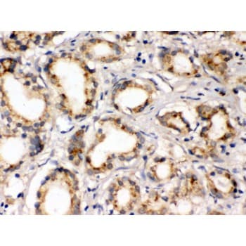 FXYD1 / Phospholemman Antibody (aa21-92)