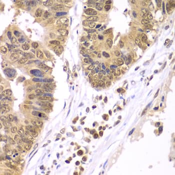 Polyclonal Rabbit anti-Human IKBKB / IKK2 / IKK Beta Antibody (IHC, IF, WB)