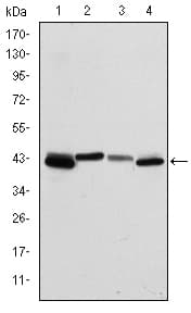 KRT19 / CK19 / Cytokeratin 19 Antibody (clone 4E8)