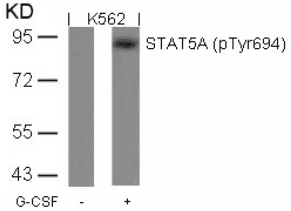 STAT5A Antibody