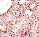 ARFGAP1 Antibody (aa377-406)